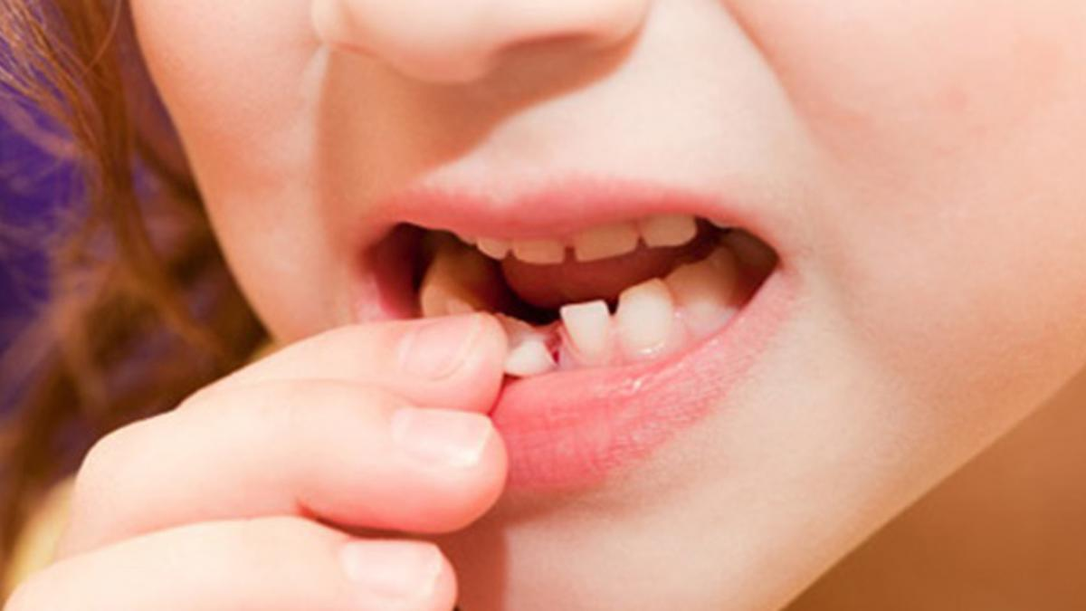 Mơ gãy răng đánh con gì? Topdoithuong365 Giải mã giấc mơ gãy răng
